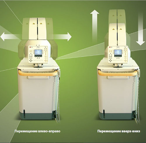 Мобильная диагностическая интраоперационная рентгеновская система O-arm рис.4